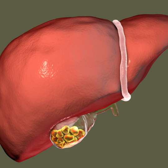 Gall Bladder Surgery at Spire Hospital<br />
