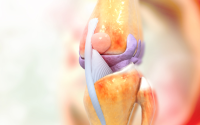 Hip and Knee Joint Replacement: What You Need to Know