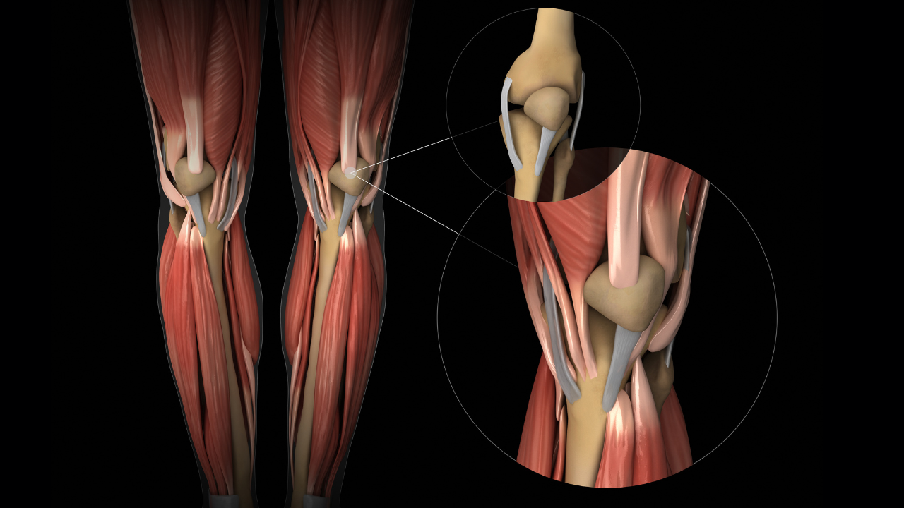 Complex Ligament Reconstruction