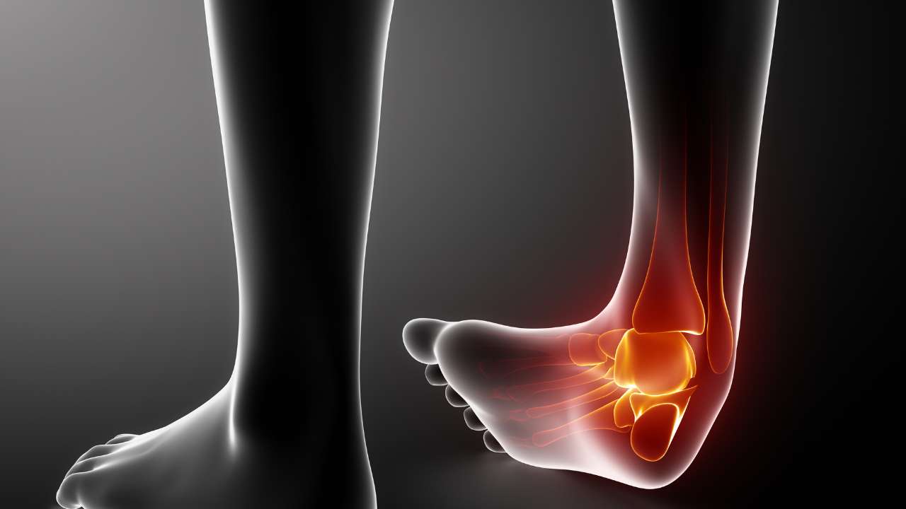 Ankle Deformity Correction